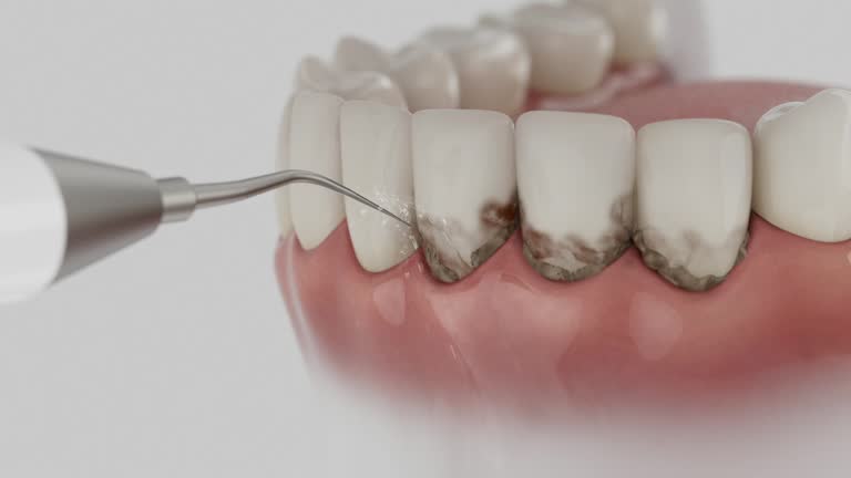 Trusted Wisdom Tooth Removal service in Moweaqua, IL - Dentist Open Now